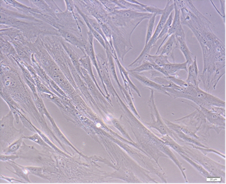 Zdjęcie przedstawia mezenchymalne komórki macierzyste
